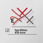 egg whites for acne